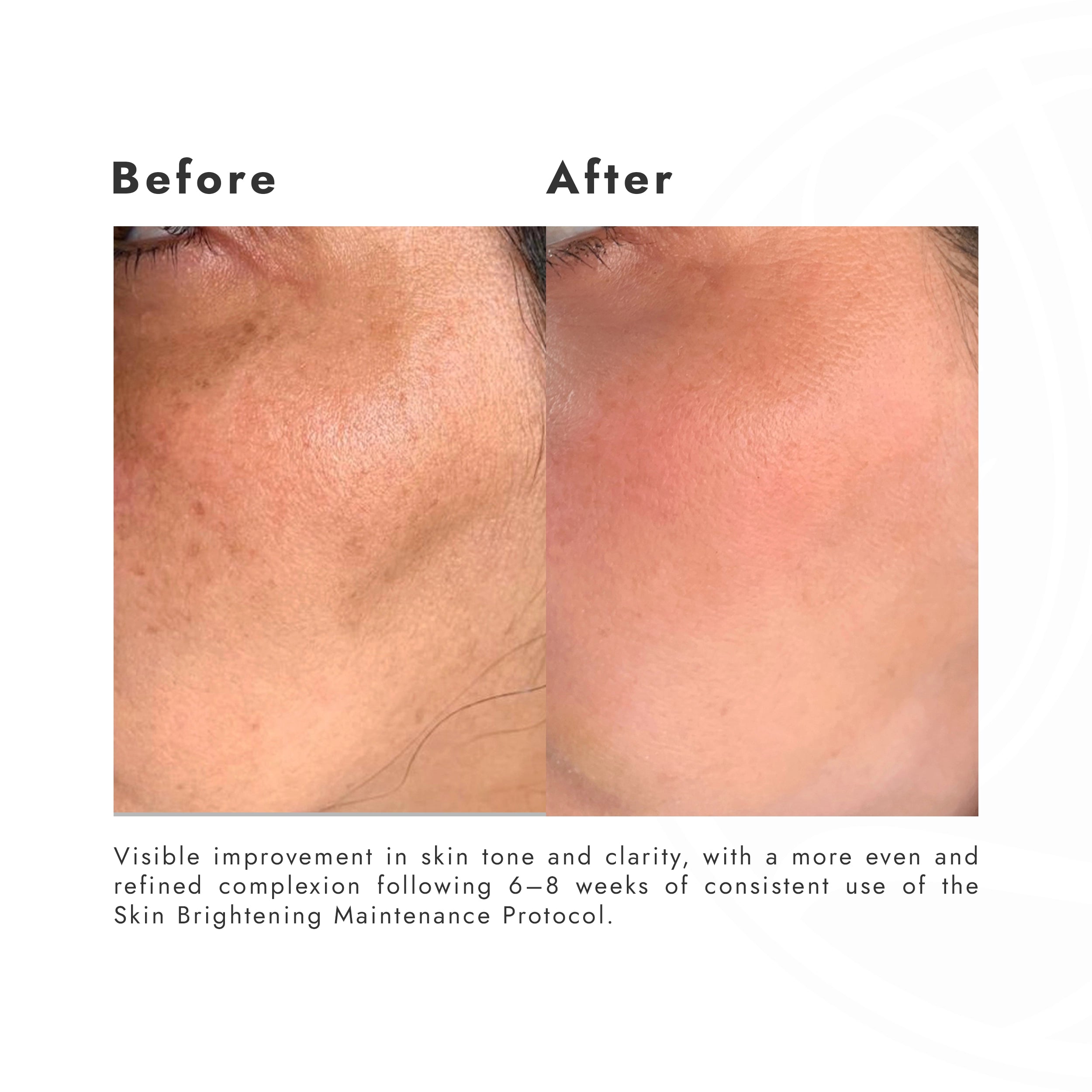 SKIN BRIGHTENING MAINTENANCE PROTOCOL