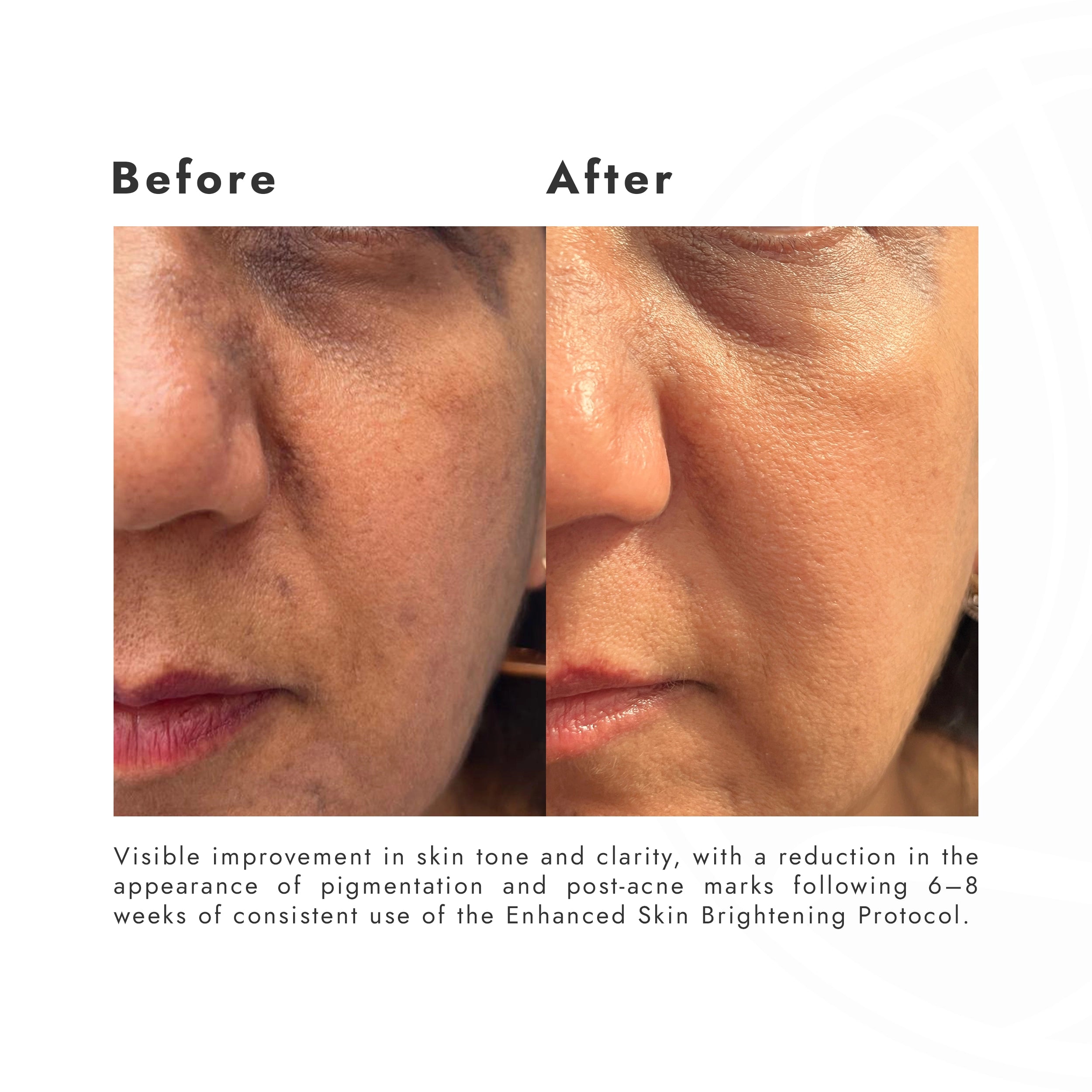 ENHANCED SKIN BRIGHTENING PROTOCOL